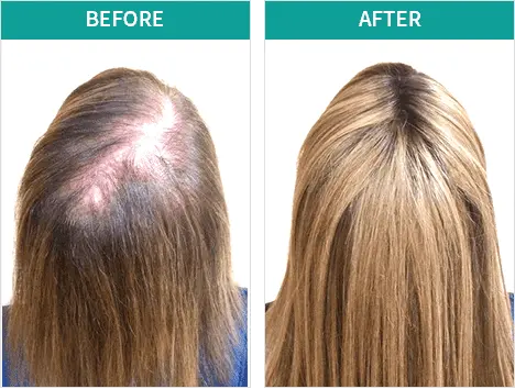 biogrow before after results